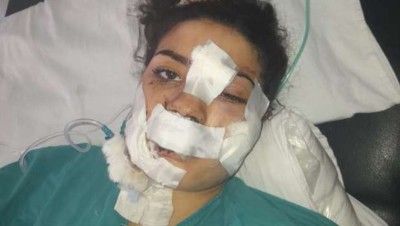 بالفيديو.. إسراء عماد تكشف ما تعرضت له من اعتداء وحشي