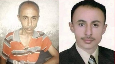 الإفراج عن صحفي يمني اعتقله الحوثيون وصورة تظهر مدى وحشيتهم