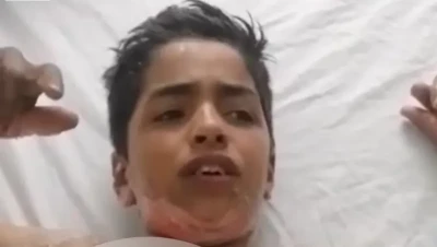 جريمة مروعة تهز الأردن: طلاب يحرقون زميلهم بالمدرسة والضحية يناشد العدالة